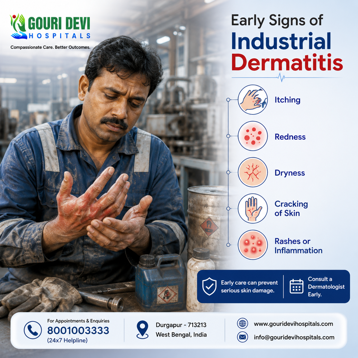 Early Signs of Industrial Dermatitis
