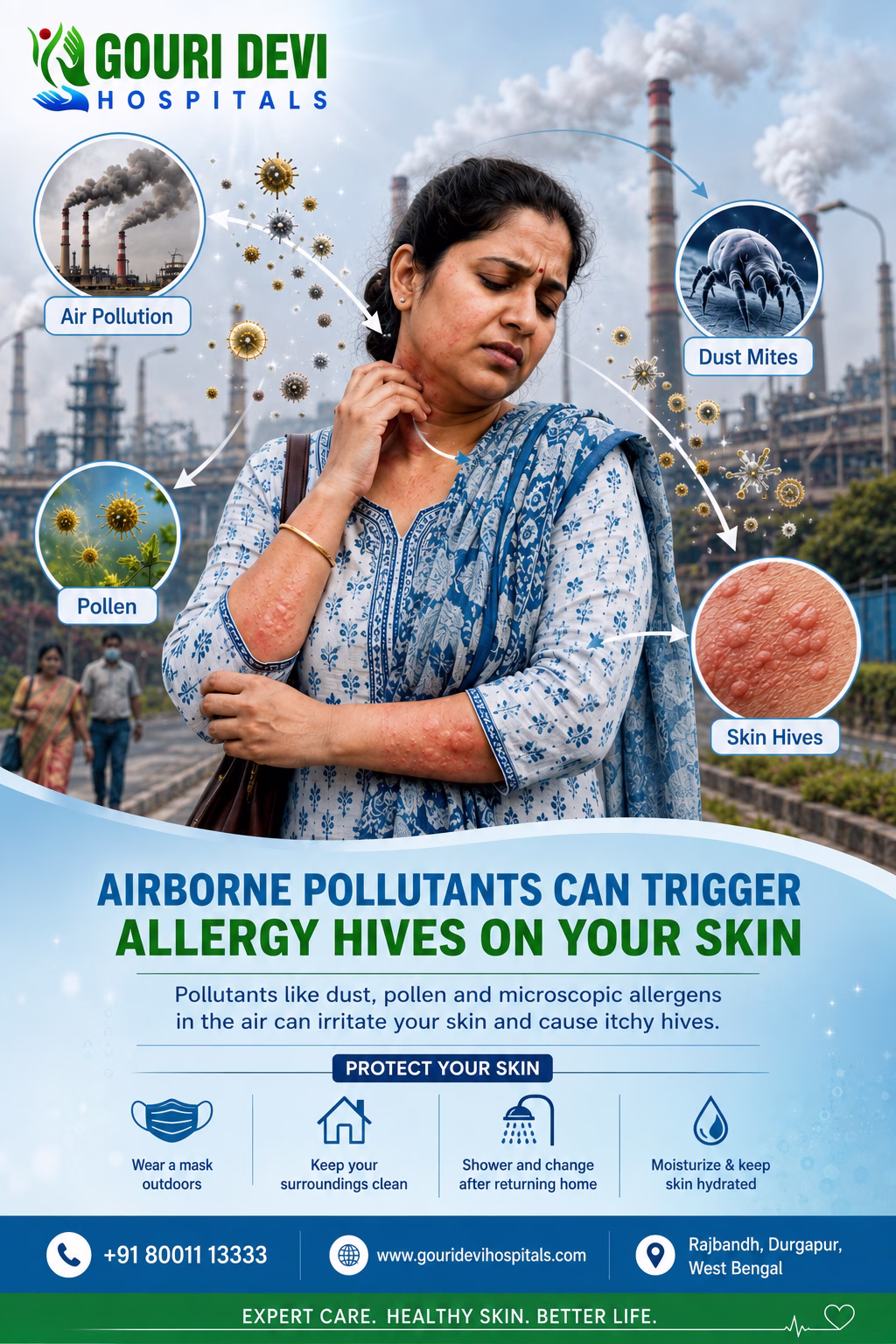 Airborne Pollutants Cause Allergic Hives on Skin